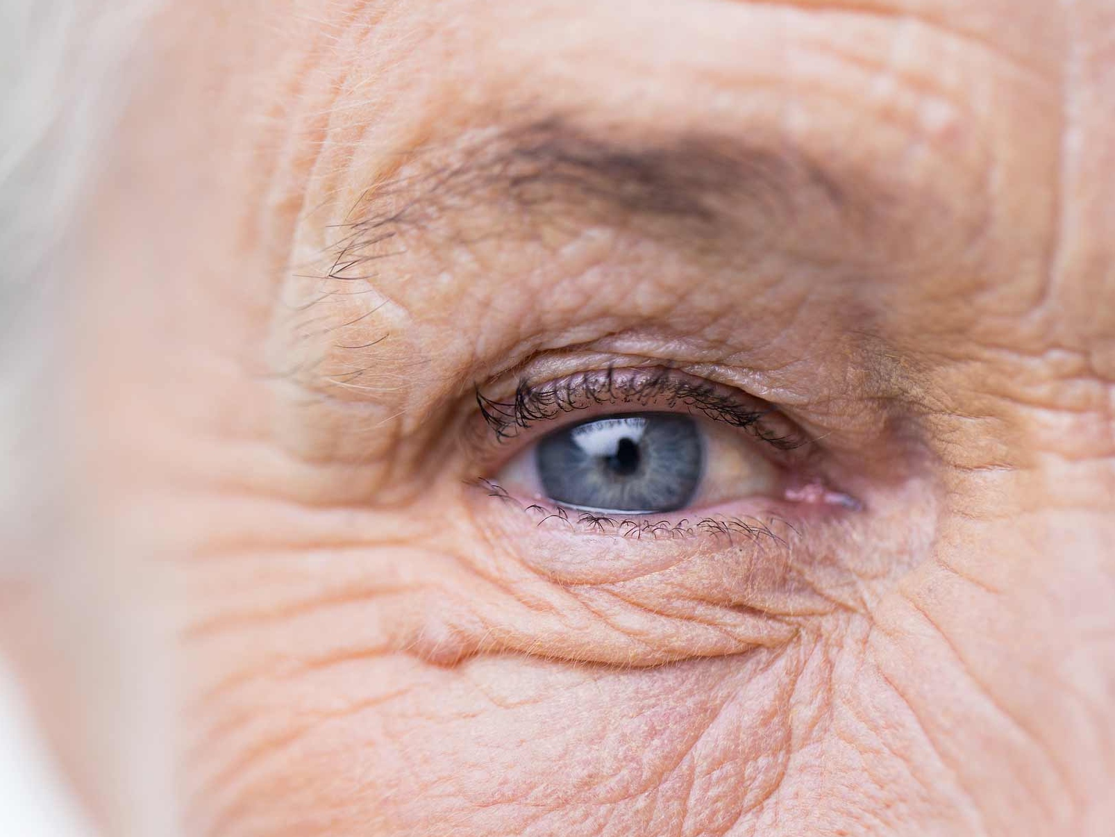 Pohled zblízka na nezdravé oko, který ilustruje možná rizika oční adnexe. 